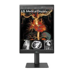Monitor de Diagnóstico LG de 21.3
